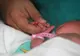 Ministrul Sănătății, amănunte de ultima oră despre cazul bebelușilor cu sindrom hemolitic-uremic