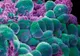 Leguma care distruge celulele canceroase. Cum se consumă