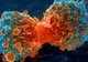 Un tratament experimental împotriva cancerului are rezultate excepţionale