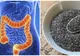 Probabil cel mai bun remediu natural pentru cancerul de colon. Din păcate, puțină lume îl știe