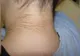 Mama a observat o pată de culoare închisă pe gâtul fiicei sale… Diagnosticul a fost un adevărat șoc!