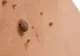 Adevărul şocant despre aluniţe
