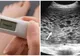 Testul a arătat că e însărcinată și era fericită. La prima ecografie, medicul s-a îngrozit