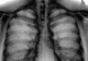 Adevărul despre radiografii. Ce se întâmplă, de fapt, când razele X intră în organismul nostru