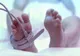Adevărul despre sindormul hemolitic-uremic. Cum pot copiii să se îmbolnăvească