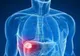 Cum ne detoxifiem ficatul după Paşte? Acesta este cel mai simplu remediu natural