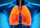 Acestea sunt primele semne ale cancerului pulmonar. Mergi urgent la medic dacă ai aceste simptome