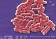 Începutul sfârșitului? Prima bacterie rezistentă la antibiotice, depistată în SUA la o pacientă