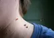 Aşa scapi de negi peste noapte! Metoda care a luat prin surprindere lumea medicală 