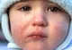 Premieră în România: angajaţii spitalului de Pediatrie,protest alături de copii şi părinţii acestora