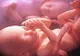 Un copil l-a purtat pe fratele său geamăn în pântece timp de 15 ani. Ce au decis medicii
