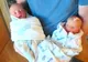 A născut gemeni perfecţi. Într-o zi blestemată, doctorii au descoperit o diferenţă înfiorătoare!
