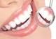 Tehnologie revoluționară! Cum să-ți faci un implant dentar reușit