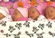 Mama a născut cvadrupleti. Apoi, medicul s-a uitat la fețele bebelușilor. A înțeles imediat că...