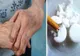 Acest preparat din 3 ingrediente simple întăreşte oasele cu 20 de ani