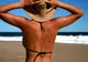 Ai stat prea mult la plajă? Cum vindeci arsurile solare cu puţin pepene galben şi lapte
