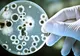Este mai puternic decât antibioticele. Alimentul care distruge toate bacteriile