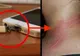 Atentie: arsuri ingrozitoare din cauza unui obiect pe care si tu il folosesti