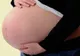 A ajuns la spital pentru naștere fără să se aștepte la ce a urmat. Ce i-a scos medicul din burtă