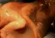 Un bebeluş respiră în sacul amniotic intact, după o naştere prin cezariană. Imagini impresionante!