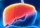 Ai ficatul gras? Iată ce înseamnă, de fapt, acest lucru! Medicii trag un semnal de alarmă
