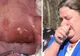 I-au aparut afte în gât, însă medicii au ignorat-o. De ce A MURIT, de fapt, o fetiţă de 10 ani