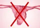 Medicii avertizează: acest tip de lenjerie intimă favorizează cancerul!