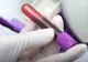 Oamenii de ştiinţă au demontat mitul Pacientului ZERO infestat cu HIV