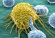 Au fost ținute secrete până acum. 5 riscuri de cancer la care ne expunem zilnic