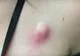 S-a trezit cu o mică înțepătură, însă în 2 zile s-a transformat complet. Când a mers la doctor. ȘOC