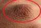 Privește-ți atent palmele. Poți afla dacă suferi de cancer