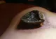 DUREROS! A fost muşcat de un raton, în pădure. Şi-a RUPT coaja de la rana creată. Ce era dedesubt