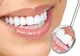 Şi adulţii îşi pot corecta anomaliile dentomaxilare, nu numai copiii. Iată cum 