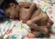 Transformare incredibilă a unui orfan din Bulgaria, după ce a fost ADOPTAT. La 7 ani, avea 3 kg