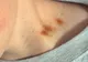 A murit la câteva ore după ce a fost muşcat de gât de iubita sa. Şocant! Ce s-a aflat la autopsie