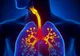 Acest aliment pe care îl consumi zilnic te poate îmbolnăvi de cancer la plămâni