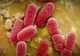 O bacterie rezistentă la toate tipurile de antibiotice a făcut deja o victimă