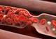 Fructul care previne formarea cheagurilor de sânge şi reduce riscul de accident vascular cerebral