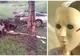 Un accident monstruos i-a zdrobit trupul. La operație, doctorii i-au decopertat fața. Cum arată acum