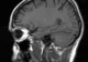 "Femeia asta nu ar trebui să fie în viaţă!" Ce au descoperit medicii la radiografie