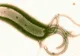 Leguma care omoară bacteria helicobacter pylori, cea care cauzează ulcerele