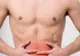 O soluţie simplă pentru hernia abdominală, care scade spectaculos riscul recidivei