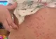Fiica ei s-a umplut de pete roșii pe piele. Motivul? Un produs pe care mulți copii îl folosesc