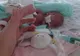 Fetiţa cât o palmă s-a născut cu 4 luni înainte de termen. 10 chirurgi au operat-o de urgenţă şi...