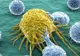 De ce apare cancerul și la oamenii care au o viață sănătoasă. Ți se face pielea de găină