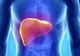 Cum poate fi prevenită ciroza hepatică
