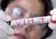 Ai aceste simptome? Mergi de urgenţă la medic! Ai putea fi infectat cu HIV
