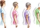 Cum prevenim osteoporoza cel mai simplu