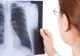 Beneficiile şi riscurile radiografiei! La ce interval de timp putem repeta procedura
