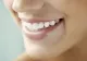 Dentiștii nu vor ca tu să afli asta! Cum să scapi de TARTRU cu un singur ingredient din bucătărie